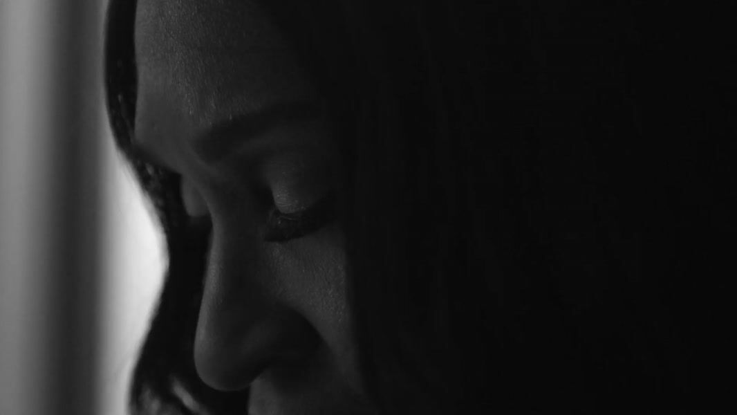 Patient smile transformation story